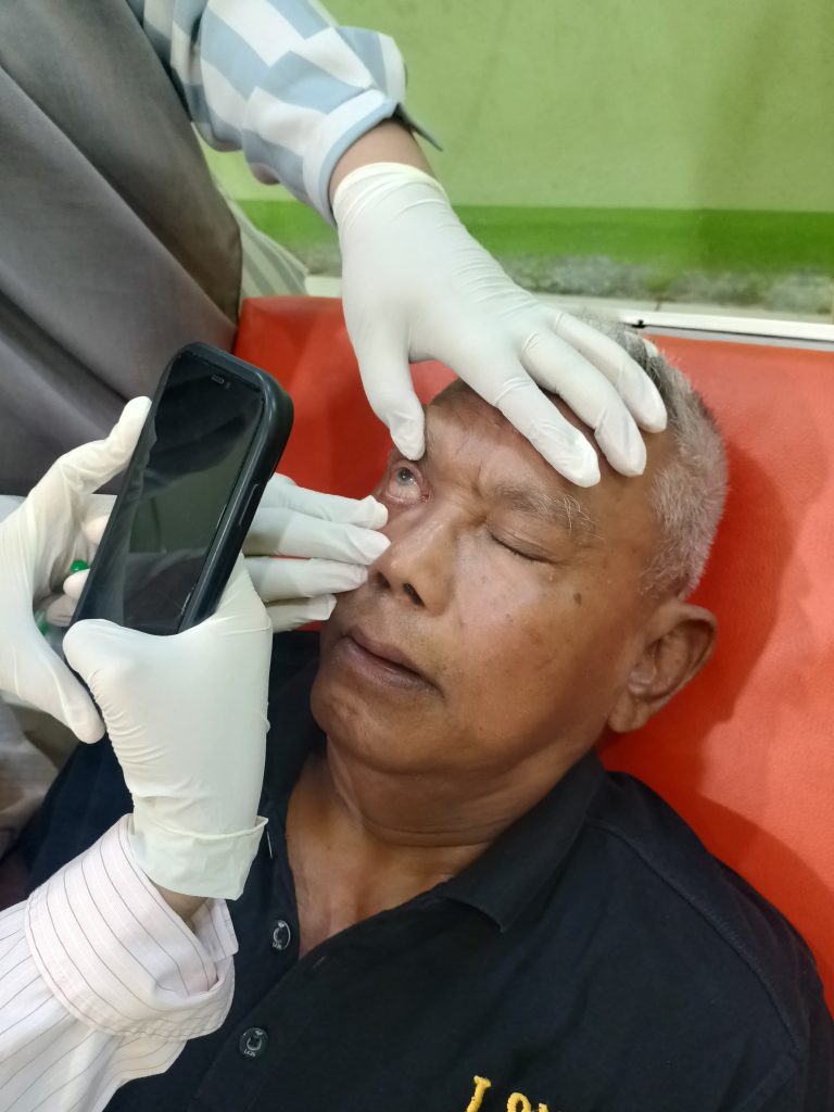 Wartawan Bj. Rahmad Bantah Edi Busti: Mata Saya Ditusuk, Penglihatan Sampai Kabur!